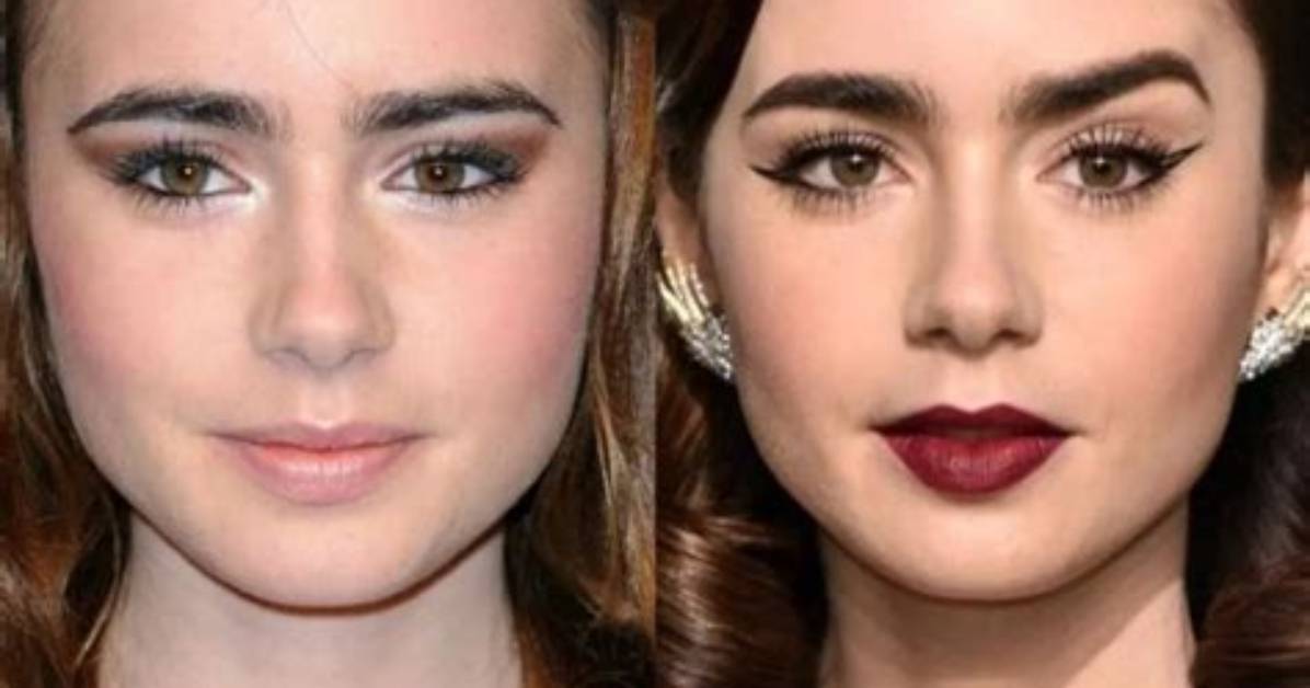 Actress Lily Collins Botox and Lip Filler with Her Before Ad After Photos
