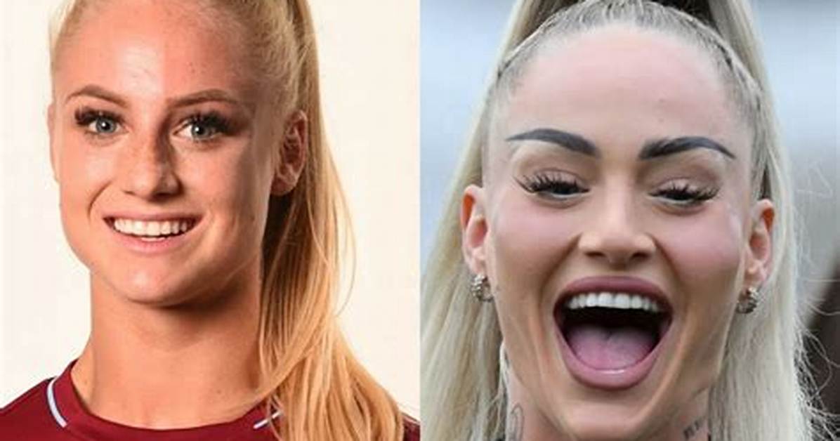 Alisha Lehmann's Plastic Surgery: 2024 Predictions & Impact