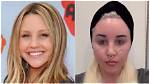 Amanda Bynes' Controversial Face Piercing: a Transformation Journey