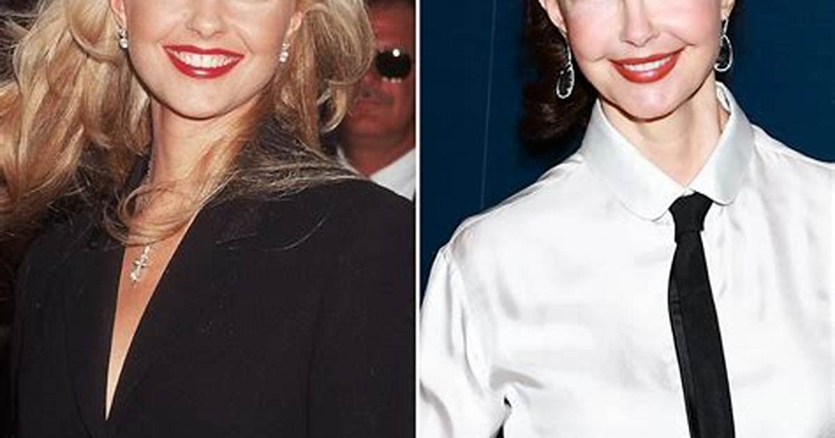 Ashley Judd's Facial Transformation: the Truth Behind the Rumors