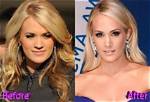 Carrie Underwood Plastic Surgery: Before and After Looks