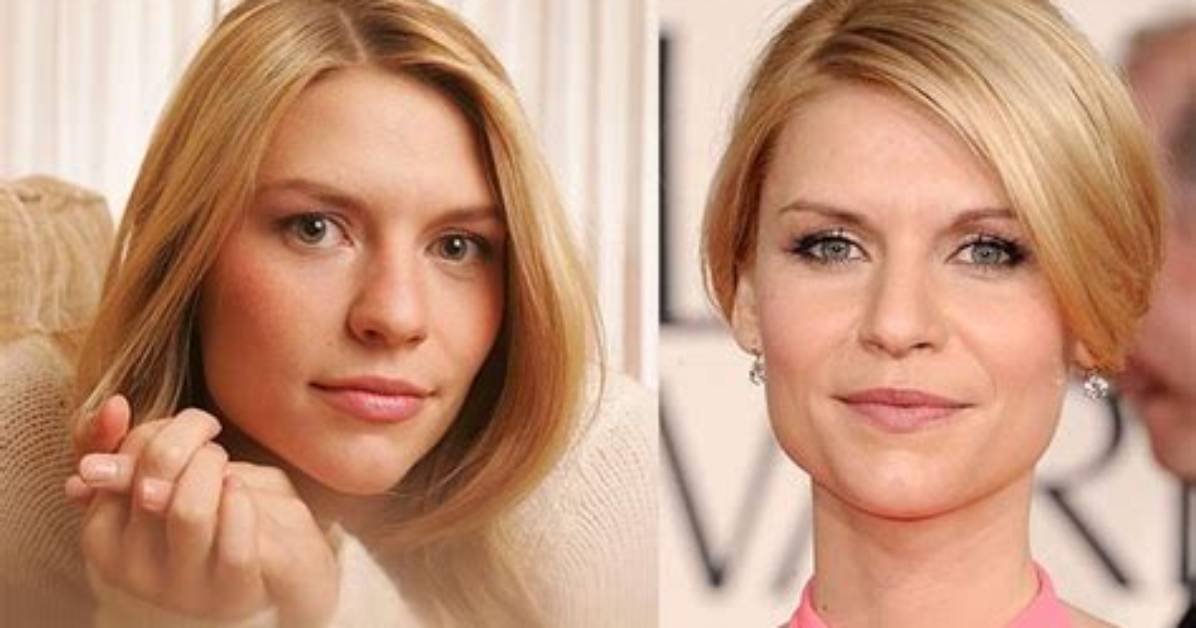 Claire Danes Plastic Surgery Before and After |