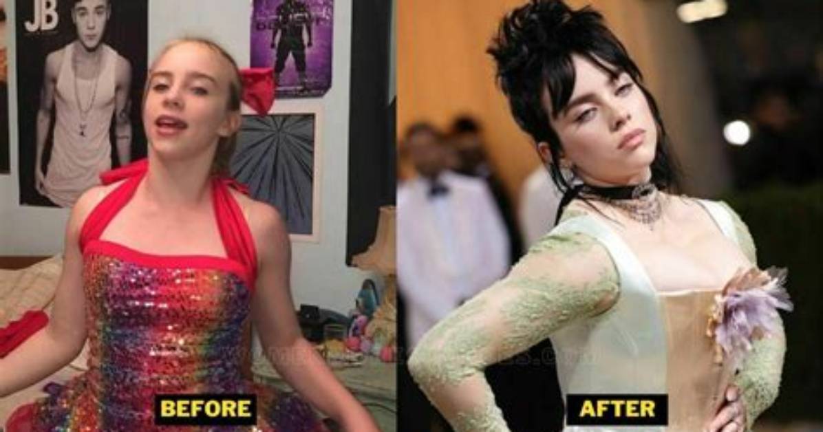 Did Billie Eilish Have Breast Reduction? a Comprehensive Analysis