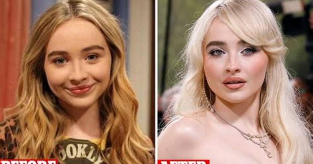 Dissecting Sabrina Carpenter's Breast Implants: a Detailed Analysis