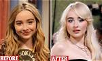 Dissecting Sabrina Carpenter's Breast Implants: a Detailed Analysis