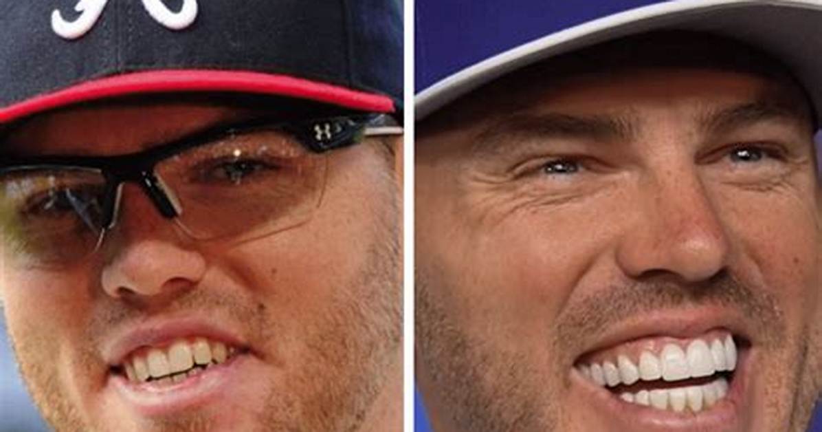 Does Freddie Freeman Have Fake Teeth? Before and After Pictures Suggests He at Least Has Veneers
