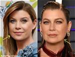 Ellen Pompeo Scars: a Journey Through Challenges and Triumphs