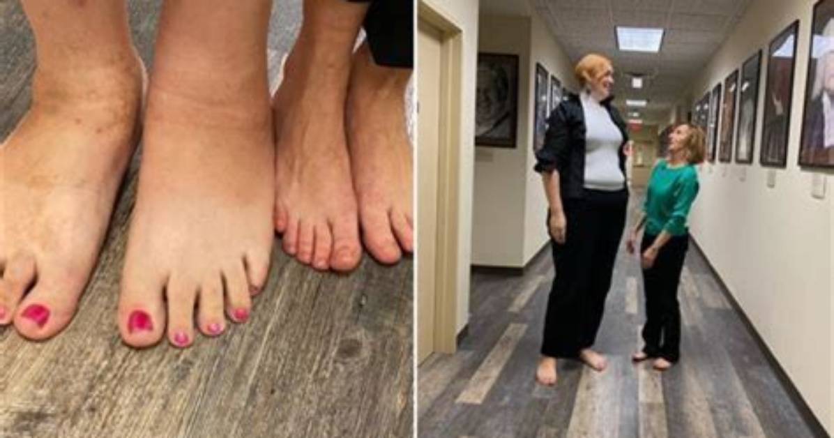Exploring the Fascinating World of Big Feet Tiktok