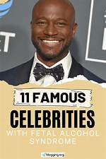 Fetal Alcohol Syndrome Celebrities: Breaking the Stigma