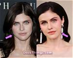 Has Alexandra Rose Had Plastic Surgery on Chin? Before and After Photos on Ig