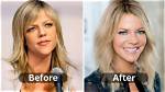 Kaitlin Olson Plastic Surgery Biography, Family, Career, History, Height
