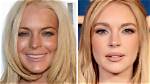 Lindsay Lohan's Face Transformation: Uncovering the Truth