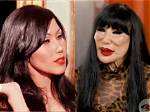 Lyn May: the Transformation Through Plastic Surgery