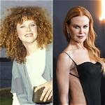 Nicole Kidman's Transformation: Unveiling Her 2024 Plastic Surgery