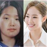 Park Min-Young's Plastic Surgery Journey: Unveiling the Transformation