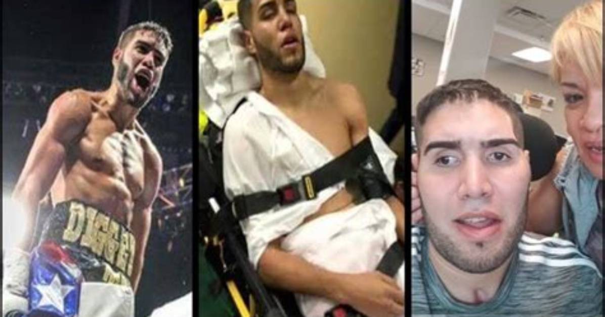 Prichard Colon Before and After: a Transformation Story
