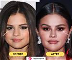 Selena Gomez Plastic Surgery: the Truth Behind the Rumors