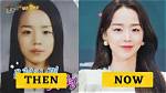 Shin Hye-Sun Surgery: Unveiling the Story Behind the Star's Transformation