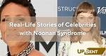Sparkling Actresses with Noonan Syndrome: Inspiring the World
