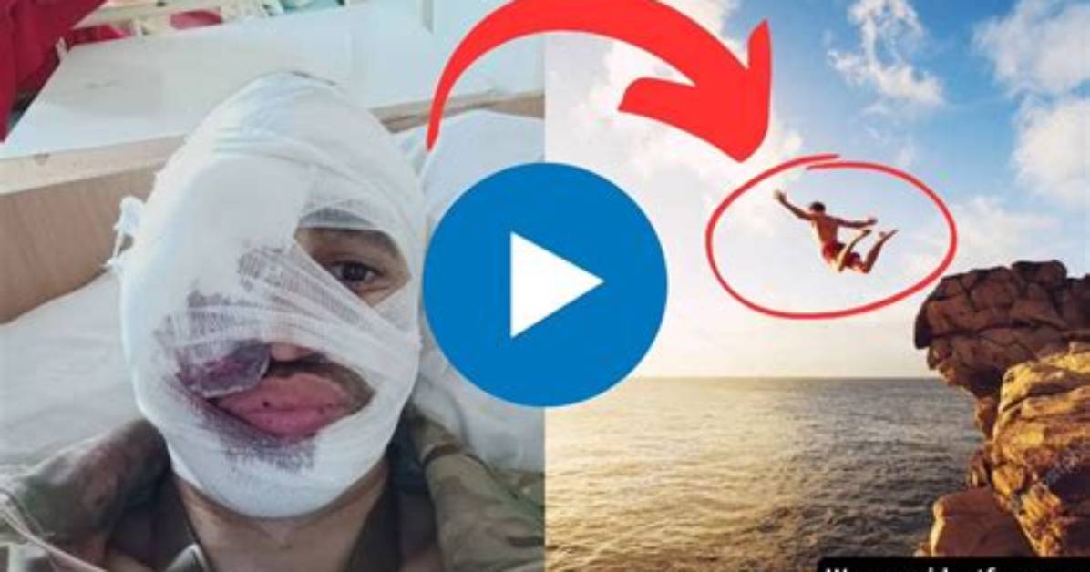 Split Face Diving Accident: the Shocking Story of a Teenagers Near-Fatal Injury