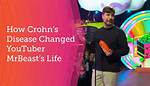 Suffering from Crohns Disease, Mrbeast Created Vegan Feastables as He Believesnormal Chocolate C