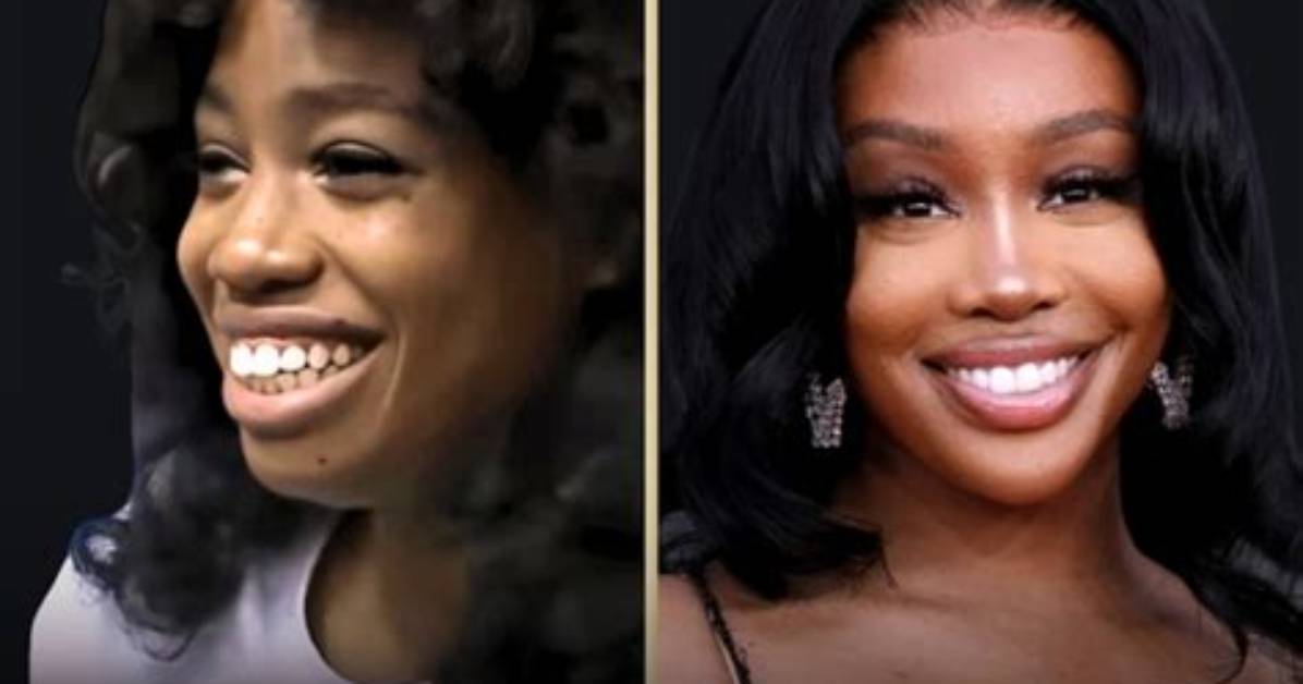Sza Nose: a Comprehensive Look into Her Distinctive Feature