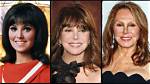The Evolution of Marlo Thomas' Nose: a Cosmetic Journey Explored