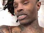 Unraveling the Tragedy: King Von's Gunshot Wound and Its Aftermath