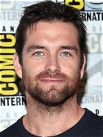 Unveiling the Truth Behind Antony Starr Hair Loss