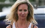 What Happened to Lady Victoria Hervey’s Face Drop and Mouth?