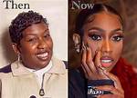 What Happened to Missy Elliott Teeth: Has She Whitened Them?